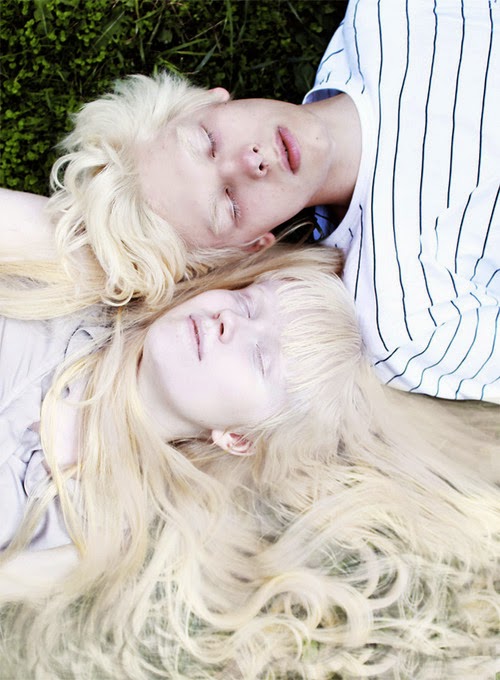 albinismo-pessoas-albinas-irmãos-albinos