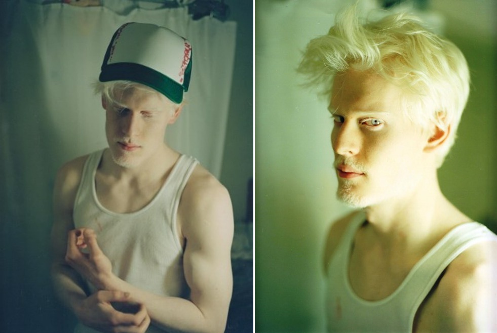 Stephen Thompson, o modelo albino da Givenchy que posou em uma campanha estrelada também pela modelo transsex Lea T.